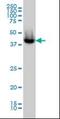 Acyl-CoA Thioesterase 9 antibody, orb89783, Biorbyt, Western Blot image 