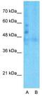 Lipolysis Stimulated Lipoprotein Receptor antibody, GTX49086, GeneTex, Western Blot image 