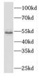 Malic enzyme 2 antibody, FNab05080, FineTest, Western Blot image 