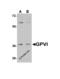 Platelet glycoprotein VI antibody, 4769, ProSci Inc, Western Blot image 