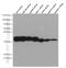 Pyrroline-5-Carboxylate Reductase 1 antibody, 66510-1-Ig, Proteintech Group, Western Blot image 