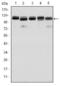 Bone Morphogenetic Protein Receptor Type 2 antibody, GTX60415, GeneTex, Western Blot image 
