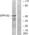 G Protein-Coupled Receptor 152 antibody, LS-B11861, Lifespan Biosciences, Western Blot image 