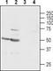 Gamma-Aminobutyric Acid Type A Receptor Gamma1 Subunit antibody, TA328817, Origene, Western Blot image 