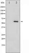FYN Proto-Oncogene, Src Family Tyrosine Kinase antibody, TA325488, Origene, Western Blot image 
