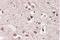 Metabotropic glutamate receptor 2 antibody, NBP1-68855, Novus Biologicals, Immunohistochemistry paraffin image 
