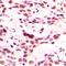 Homeobox B9 antibody, LS-C352321, Lifespan Biosciences, Immunohistochemistry paraffin image 