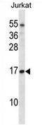Elongin C antibody, AP54199PU-N, Origene, Western Blot image 