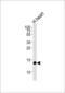 Fatty Acid Binding Protein 3 antibody, MBS9207955, MyBioSource, Western Blot image 