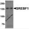 Sterol Regulatory Element Binding Transcription Factor 1 antibody, 7853, ProSci Inc, Western Blot image 