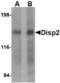 Dispatched RND Transporter Family Member 2 antibody, TA306676, Origene, Western Blot image 
