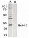 BCL10 Immune Signaling Adaptor antibody, PA5-19931, Invitrogen Antibodies, Western Blot image 
