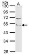 Angiopoietin Like 4 antibody, PA5-29944, Invitrogen Antibodies, Western Blot image 