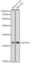 Surfactant Protein A1 antibody, GTX54714, GeneTex, Western Blot image 