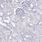 Solute Carrier Family 34 Member 2 antibody, HPA037989, Atlas Antibodies, Immunohistochemistry frozen image 