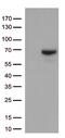 Matrix Metallopeptidase 2 antibody, TA806846S, Origene, Western Blot image 