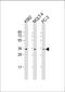 Phosphatidylinositol N-acetylglucosaminyltransferase subunit C antibody, 61-309, ProSci, Western Blot image 