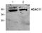 Histone Deacetylase 11 antibody, GTX18973, GeneTex, Western Blot image 