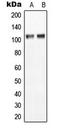 Anoctamin-7 antibody, LS-C354167, Lifespan Biosciences, Western Blot image 
