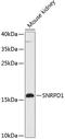 Small nuclear ribonucleoprotein Sm D1 antibody, GTX66260, GeneTex, Western Blot image 