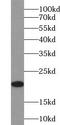 Ubiquitin Conjugating Enzyme E2 M antibody, FNab09153, FineTest, Western Blot image 