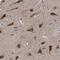 Chromosome 9 Open Reading Frame 135 antibody, HPA021325, Atlas Antibodies, Immunohistochemistry frozen image 