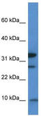Mitochondrial Ribosomal Protein S33 antibody, TA344642, Origene, Western Blot image 