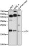 LLP Homolog, Long-Term Synaptic Facilitation Factor antibody, LS-C750500, Lifespan Biosciences, Western Blot image 