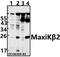 Potassium Calcium-Activated Channel Subfamily M Regulatory Beta Subunit 2 antibody, A08181-1, Boster Biological Technology, Western Blot image 