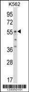 Ornithine Decarboxylase 1 antibody, 57-425, ProSci, Western Blot image 
