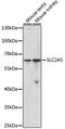 Solute Carrier Family 2 Member 5 antibody, LS-C748692, Lifespan Biosciences, Western Blot image 