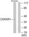 Cyclin Dependent Kinase 5 Regulatory Subunit 1 antibody, LS-C119052, Lifespan Biosciences, Western Blot image 