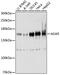 Double-stranded RNA-specific adenosine deaminase antibody, 23-240, ProSci, Western Blot image 