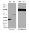 Inhibitor Of Growth Family Member 2 antibody, M04290, Boster Biological Technology, Western Blot image 