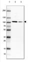 3-Hydroxy-3-Methylglutaryl-CoA Reductase antibody, NBP2-61616, Novus Biologicals, Western Blot image 