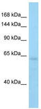 Apoptotic Chromatin Condensation Inducer 1 antibody, TA344399, Origene, Western Blot image 