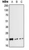 Calcitonin antibody, orb215446, Biorbyt, Western Blot image 