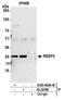 Receptor Accessory Protein 3 antibody, A305-662A-M, Bethyl Labs, Immunoprecipitation image 