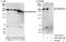 Small Nuclear Ribonucleoprotein U5 Subunit 200 antibody, A303-454A, Bethyl Labs, Western Blot image 