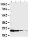 Growth Hormone 1 antibody, GTX11522, GeneTex, Western Blot image 