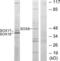 SRY-Box 8 antibody, LS-C118955, Lifespan Biosciences, Western Blot image 