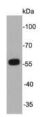 Aldehyde Dehydrogenase 2 Family Member antibody, NBP2-67131, Novus Biologicals, Western Blot image 