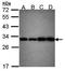Phosphoglycerate mutase 1 antibody, orb73616, Biorbyt, Western Blot image 