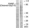 Poly(ADP-Ribose) Polymerase 1 antibody, TA313435, Origene, Western Blot image 