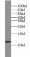 ADF antibody, FNab09033, FineTest, Western Blot image 
