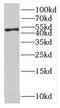Diphthamide Biosynthesis 1 antibody, FNab06045, FineTest, Western Blot image 