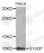 S100 Calcium Binding Protein P antibody, A7617, ABclonal Technology, Western Blot image 
