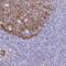 Ribonucleotide Reductase Catalytic Subunit M1 antibody, HPA057265, Atlas Antibodies, Immunohistochemistry paraffin image 