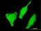 Forkhead Box O3 antibody, LS-C133203, Lifespan Biosciences, Immunofluorescence image 