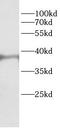 Fructose-1,6-bisphosphatase 1 antibody, FNab10418, FineTest, Western Blot image 